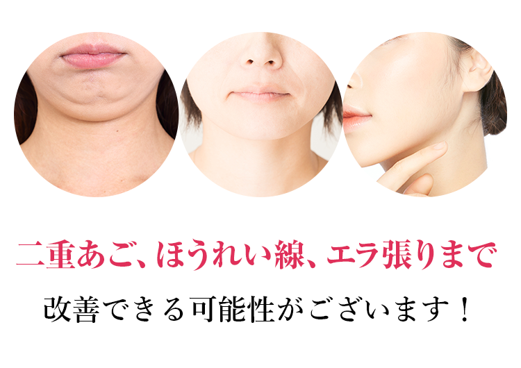 二重あご、ほうれい線、エラ張りまで改善させることができるのです！