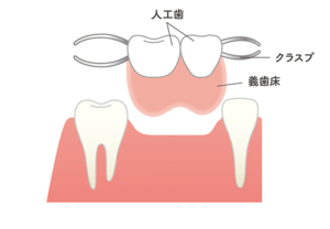 入れ歯